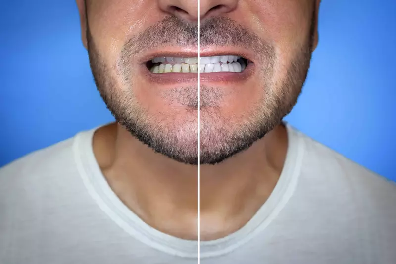 Crowns & Bridges treatment procedure